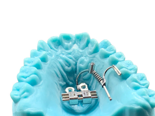 RepDistal Aligners