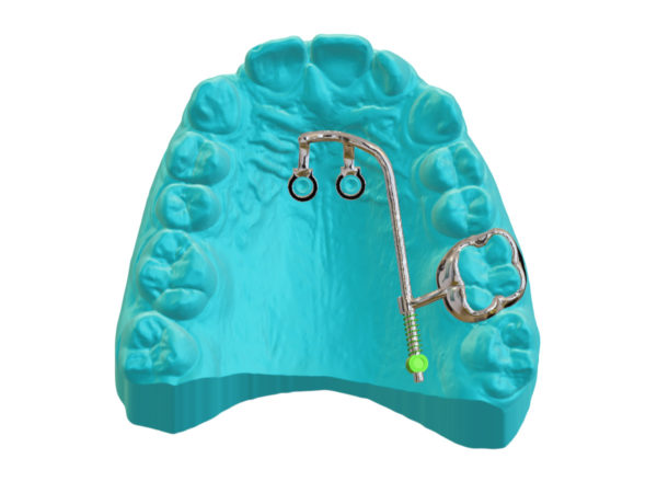 TADs Mesial2